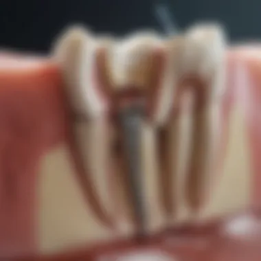 Myths vs Facts About Root Canals Chart showcasing myths and facts about root canals.