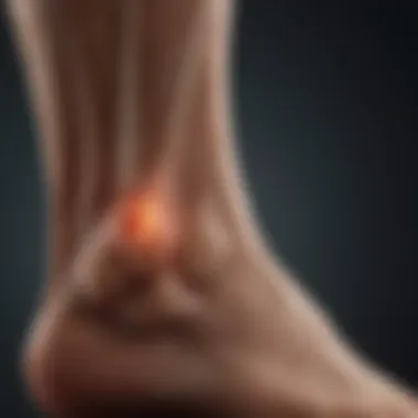 Insights into Achilles Tendonitis Visual representation of achilles tendonitis with key indicators
