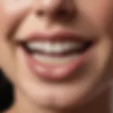 Close-up of labial veneers on teeth showcasing their aesthetic appeal