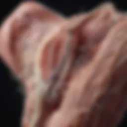 Detailed diagram of bypass graft anatomy