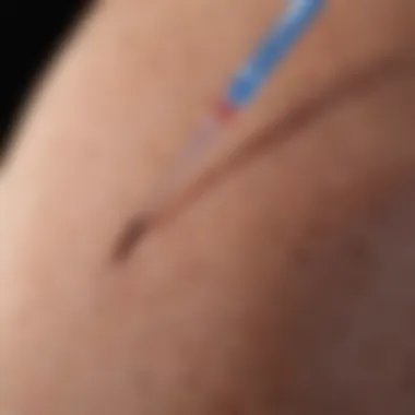Close-Up of Diabetes Needle Patch Functionality Close-up of a diabetes needle patch in use, illustrating functionality.