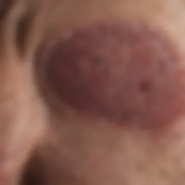 Clinical Manifestations of Mantle Lymphoma Chart showing clinical manifestations of mantle lymphoma