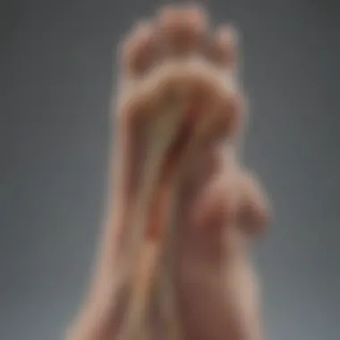 Understanding Plantar Fasciitis Diagram illustrating plantar fasciitis location and symptoms