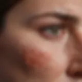 Detailed illustration of basal cell carcinoma on the face