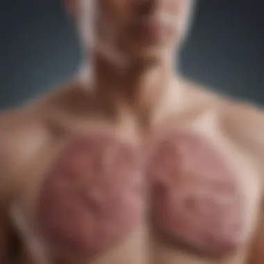 Treatment Options for Pleural Mesothelioma Overview of treatment options available for pleural mesothelioma
