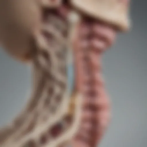 Illustration of intervertebral disc anatomy highlighting discal protrusion.