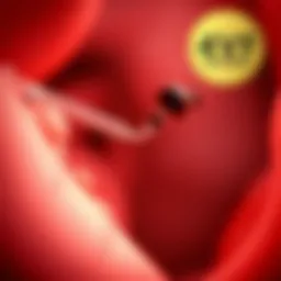 Detailed illustration of ICSI technique