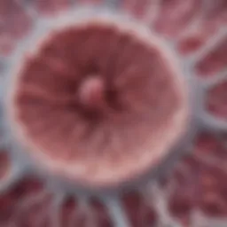 Histological slide showcasing the cellular characteristics of intraperitoneal mesothelioma