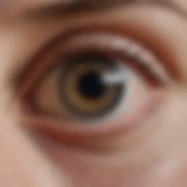 Anatomical Structure of the Conjunctiva Diagram illustrating the anatomy of the conjunctiva