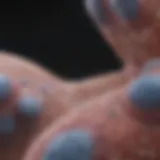 Visual representation of prostate cancer stage progression