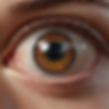 Anatomy of the Eye Affected by RA Illustration of the eye anatomy highlighting areas affected by RA