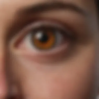 Impact of Scleritis on Vision Visual representation of scleritis and its impact on vision