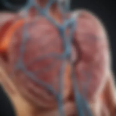 Schematic of arrhythmia treatment through radiofrequency ablation