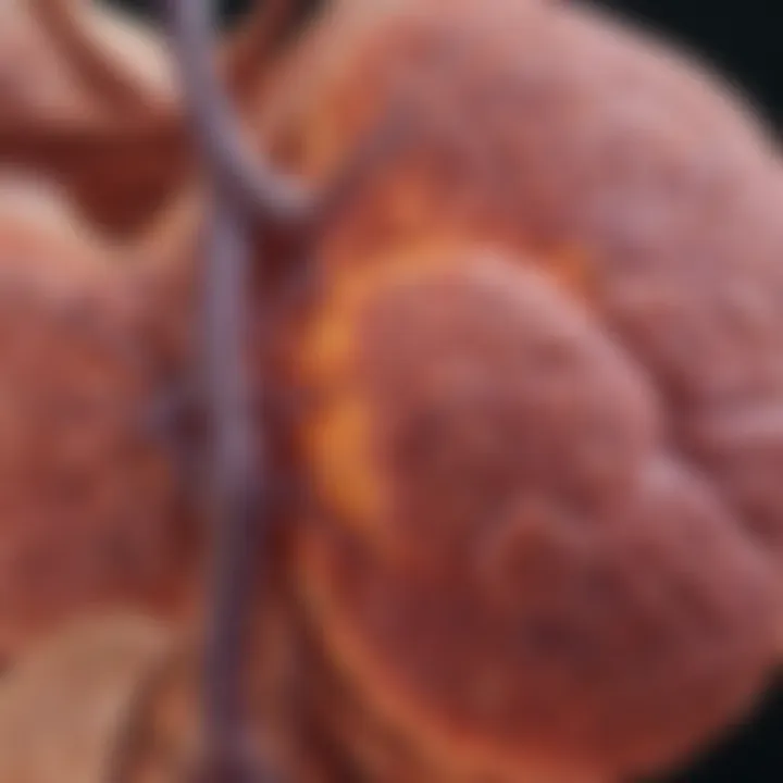 Notable Understanding Stage 4 Kidney Cancer with Lung Metastasis