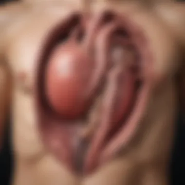 Causes of Aortic Enlargement Illustration showing causes of aortic enlargement