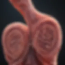 Visual representation of metastatic colon cancer stages